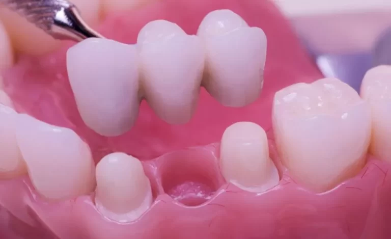 turkish dentist crown