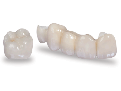 dental crown in kusadasi